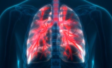 Clinical Trial Uses Immunotherapy to Treat Mesothelioma
